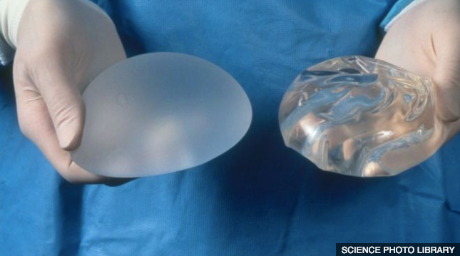 Implants and Breastfeeding: What You Should Know